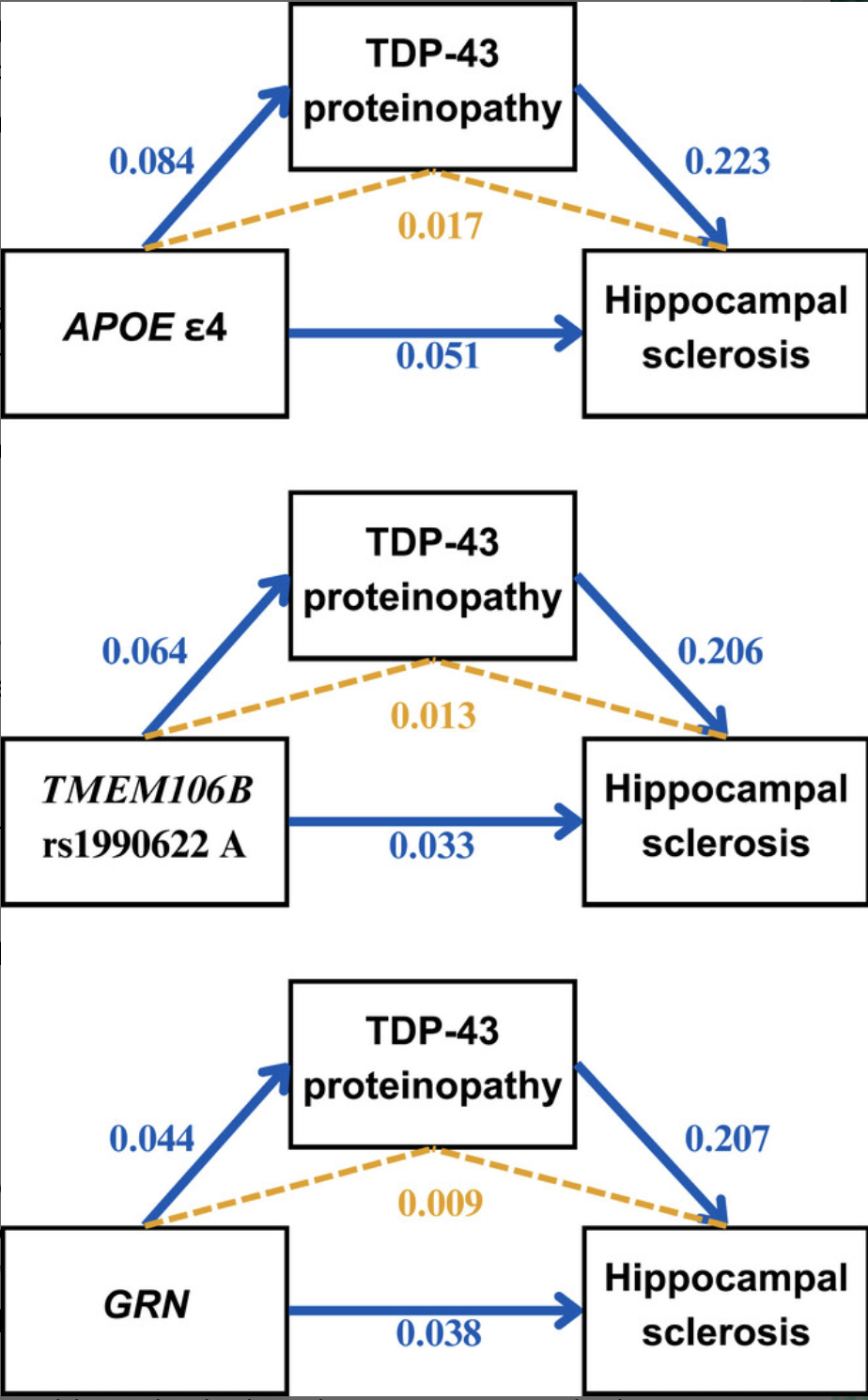 Genome wide association studies of TDP 43 proteinopathy and hippocampal sclerosis reveal shared genetic associations with APOE and TMEM106B