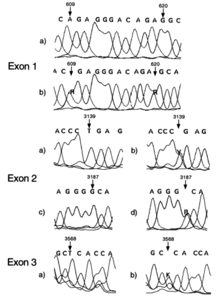 DNA sequence variation in human apolipoprotein C4 gene and its effect on plasma lipid profile