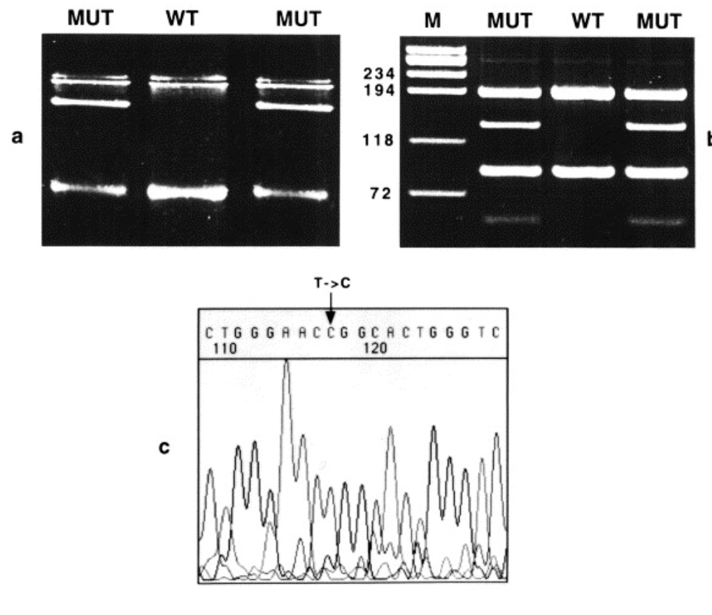 A novel mutation in the apolipoprotein E gene APOE 4 Pittsburgh is associated with the risk of late-onset Alzheimer s disease