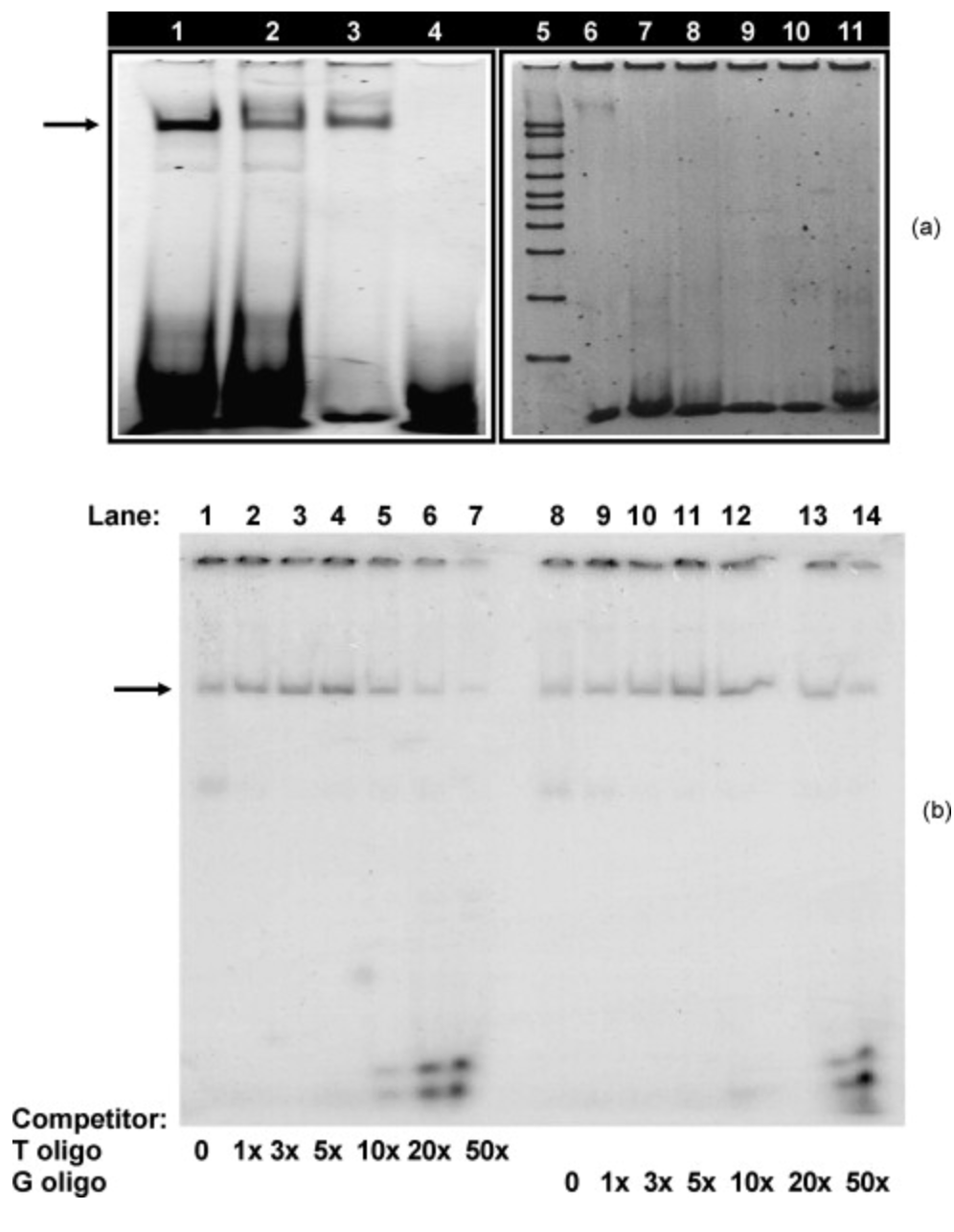 Functional significance of lipoprotein lipase HindIII polymorphism associated with the risk of coronary artery disease