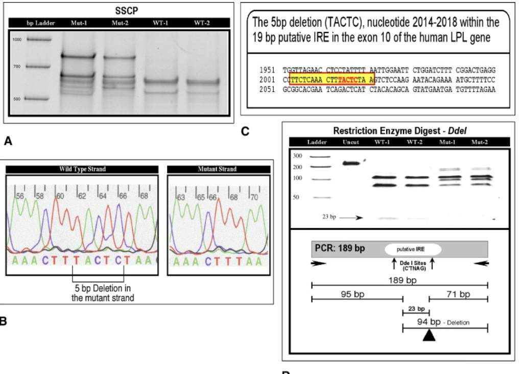 Identification and characterization of a novel 5 bp deletion in a putative insulin response element in the lipoprotein lipase gene