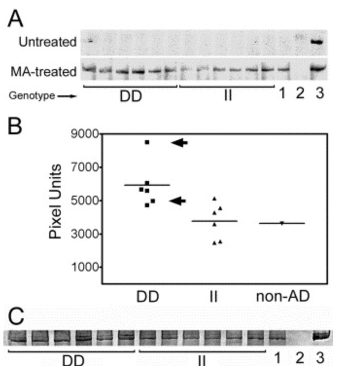 Functional analysis of plasma α2-macroglobulin from Alzheimer s disease patients with the A2M intronic deletion