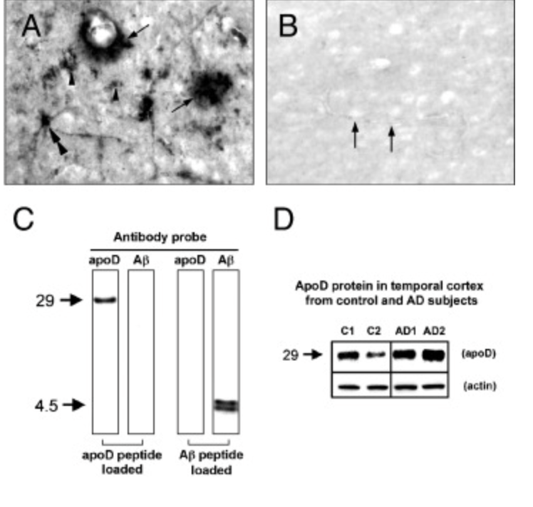 Apolipoprotein D is a component of compact but not diffuse amyloid-beta plaques in Alzheimer s disease temporal cortex