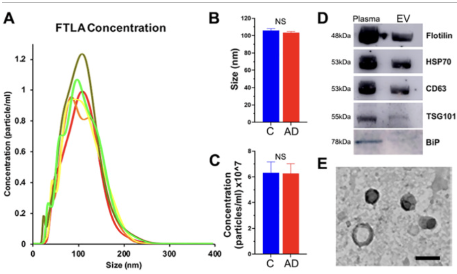 Small nucleolar RNAs in plasma extracellular vesicles and their discriminatory power as diagnostic biomarkers of Alzheimer s disease