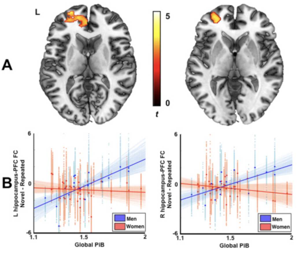 Amyloid deposition is associated with different patterns of hippocampal connectivity in men versus women