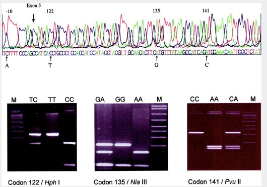 Single Nucleotide Polymorphisms in the Coding Region of the Apolipoprotein H β sub 2 sub Glycoprotein I Gene and their Correlation with the Protein Polymorphism, Anti β sub 2 sub Glycoprotein I Antibodies and Cardiolipin Binding: Description of Novel Haplotypes and Their Evolution