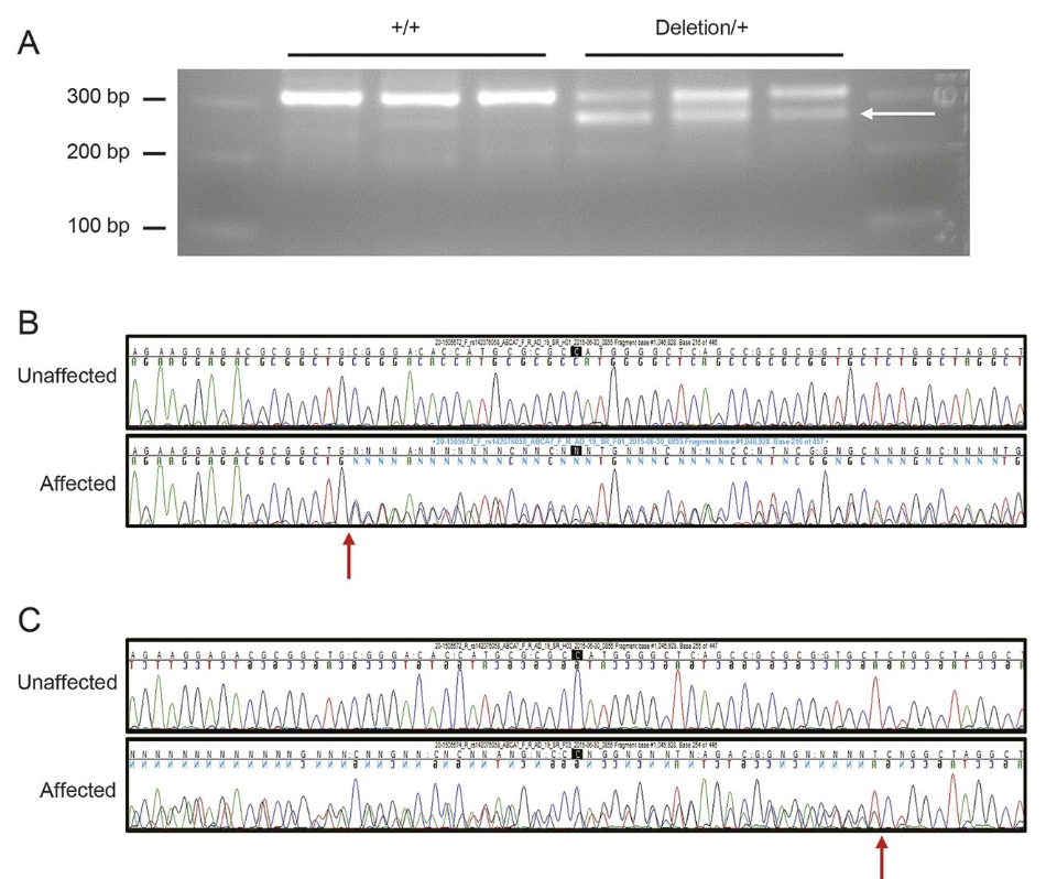 i ABCA7 i frameshift deletion associated with Alzheimer disease in African Americans