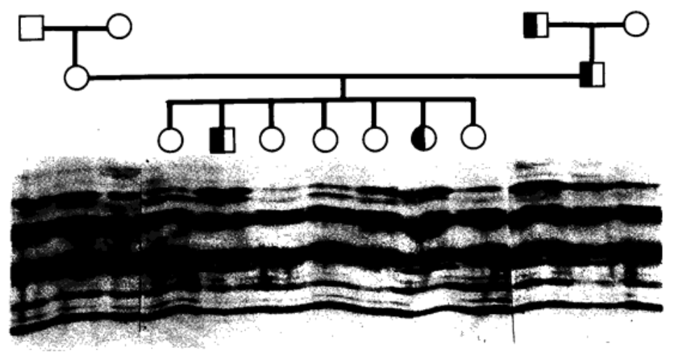 Genetic studies of human apolipoproteins. I. Polymorphism of apolipoprotein A-IV.