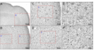 Biomarker and Neurogenetics Core